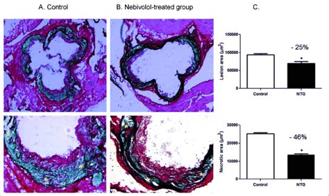 Atherosclerotic Lesions A B And Lesion Area Measurements C In The