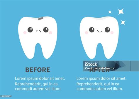 Ilustración De Antes Después De Plantilla Infográfica Conjunto De Iconos De Diente Brillante