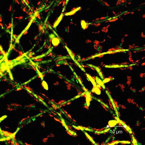 Fluorescence In Situ Hybridization Image Of C Albicans And S Aureus Download Scientific