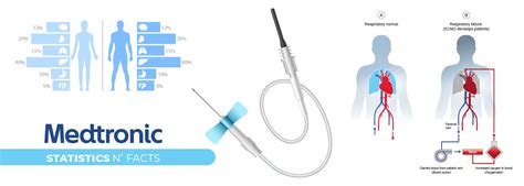 Medtronic Statistics, Facts, Revenue, Net Sales - Market.us