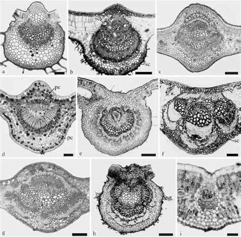 Photomicrographs And Stereomicrographs Of Cross Sections Of The Leaf Download Scientific