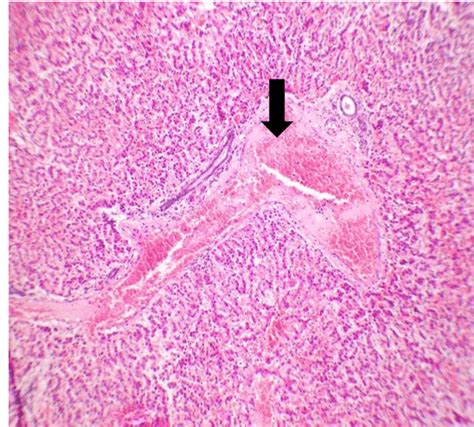 Photomicrograph Of Liver Showing Centrilobular Necrosis Hande X100 Download Scientific Diagram