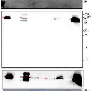 Detecting Protein Protein Interactions By Far Western Blotting The