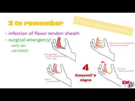 Tenosynovitis - Acute Tenosynovitis, Symptoms And Treatment | Diseases ...