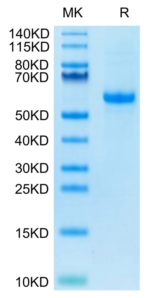 Biotinylated Human Notch 3 Protein Recombinant Reprokine