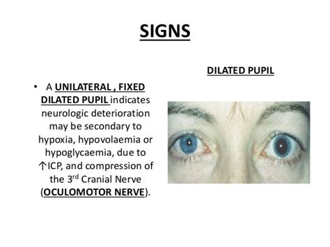 Head Injuries Overview