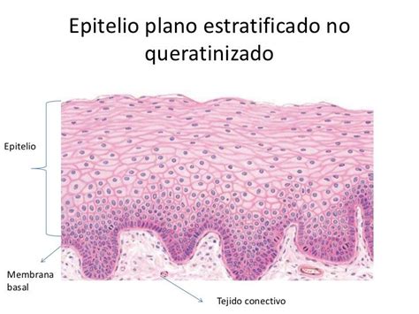 Epitelio Plano Estratificado No Queratinizado Histolog A Libros De