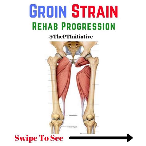 Dr Adam Mccluskey Pt Dpt On Instagram Groin Strain Rehab