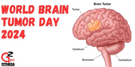 World Brain Tumor Day 2024 Know Theme History Significance And Facts