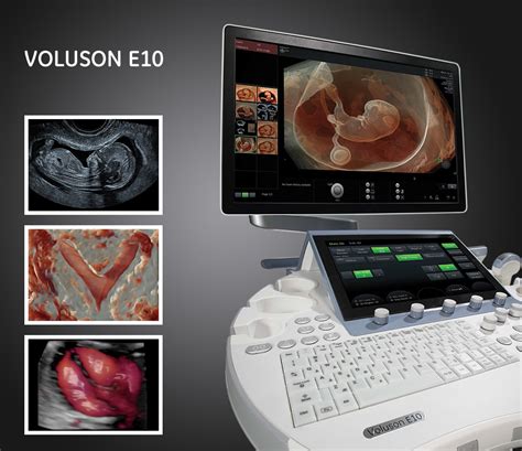 Купить УЗИ GE Voluson E10 Vital Medical Company