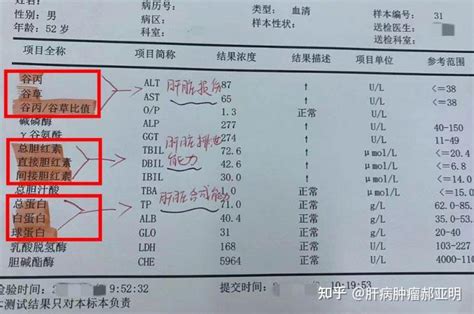 三分钟教你看懂肝功能化验单，你学会了吗？ 知乎