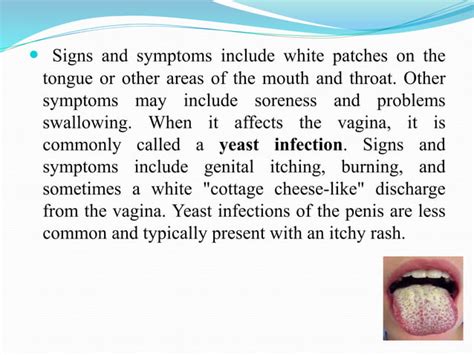 Candidiasis, causes and their treatment | PPT