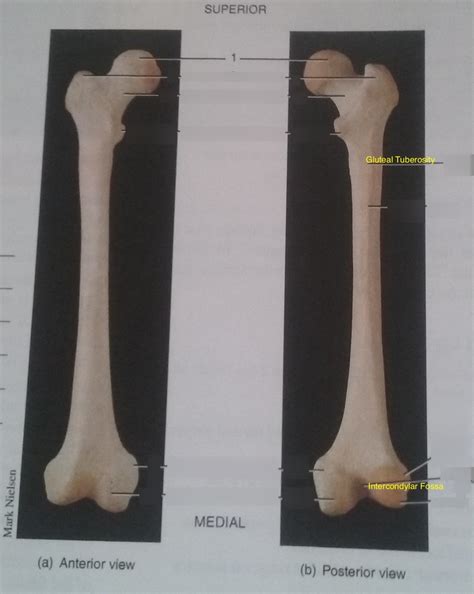 Right Femur Anterior And Posterior Diagram Quizlet