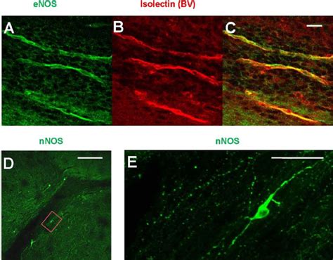 ENOS And NNOS Expression In The RMS Vasculature A C Endothelial