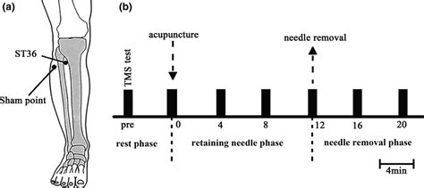 The location of Zusanli (ST36) and experimental procedure. The location... | Download Scientific ...