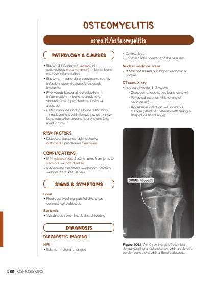 Osteomyelitis: Video, Causes, & Meaning | Osmosis