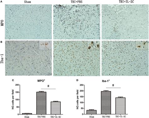 Frontiers Il Anti Il Complex Attenuates Inflammation And Bbb