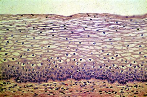 Histología y Embriologia SALÓN 218 EPITELIO PLANO ESTRATIFICADO NO