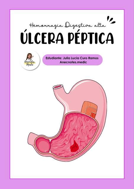 Lcera P Ptica Diagrama Julia Lucia Curo Ramos Anecnotes Medic Udocz