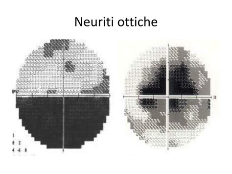 Ppt Loculistica Nella Medicina Durgenza E Le Urgenze Oculistiche