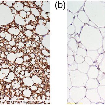 A The Histology Of The Bat Demonstrates Small Brownish Adipocytes