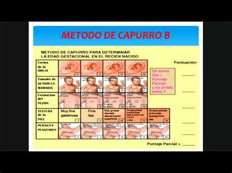 Neonatolog A Edad Gestacional Clasificaci N Del Reci N Nacido