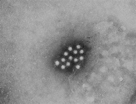 Archivohepatitis A Virus 01 Wikipedia La Enciclopedia Libre