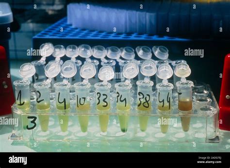 Agricultura Molecular De Plantas Prueba De Elisa Enzima Linked Immunosorbent Assay Para El