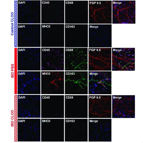 Macrophage Depletion Restores Sensory Vasodilation In Mesenteric