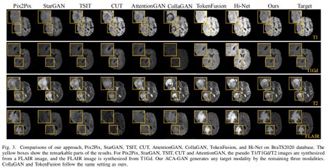 Autoencoder Based Collaborative Attention Gan For Multi Model Image