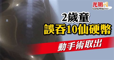 2歲童誤吞10仙硬幣 動手術取出 國內 2021 11 19 光明日报