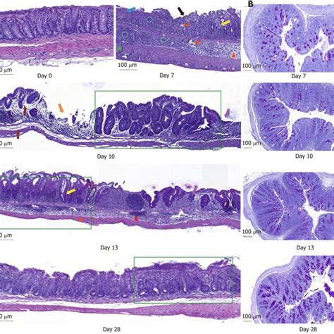 Histological Examination Of Longitudinal And Transversal Colonic Download Scientific Diagram