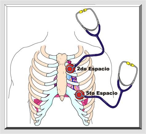 Figura L2 14 4 Ubicación Anatómica del Estetoscopio La figura ilustra