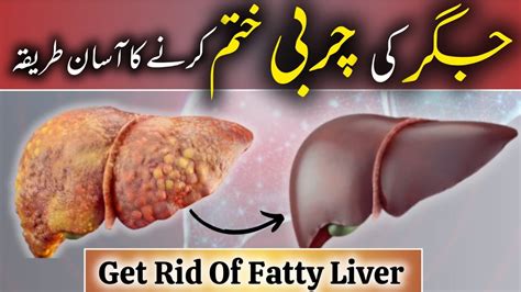 Jigar Ki Charbi Ka Ilaj Natural Liver Detox Fatty Liver Kya Hota