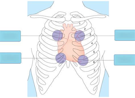 heart sound locations Diagram | Quizlet