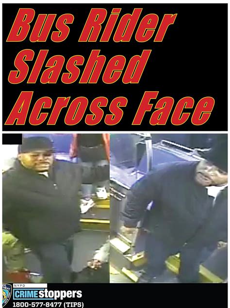Bronx Bus Rider Slashed Across Face : r/CrimeInNYC