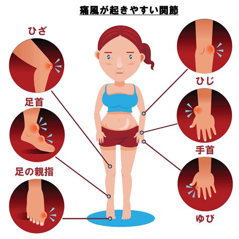 「痛風予防のカギ」尿酸値管理の重要性と正しい方法 あかし内科クリニック