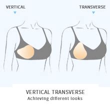 Amazon Artificial Symmetrical Breast Form Post Mastectomy Breast