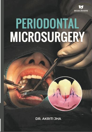 PERIODONTAL MICROSURGERY Online Book Stores