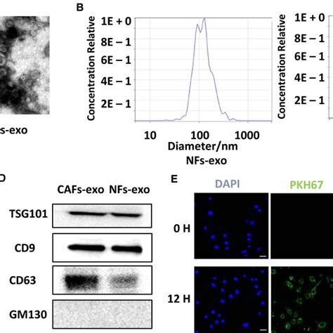 Isolation Characterization And Internalization Of Exosomes Derived