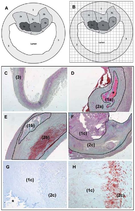 Figure From The Expression Of Glycophorin A And Osteoprotegerin Is