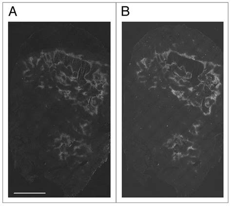 Tumor hypoxia after Atrasentan administration. (A) Pimonidazole ...