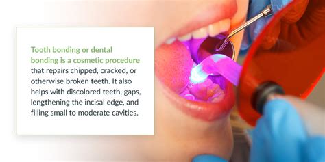 A Guide to Teeth Bonding | 209 NYC Dental