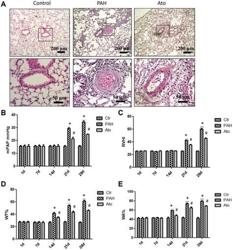 Ato Improved The Lung Function Of Pah Rats A Pathological Changes Of