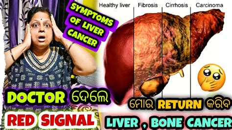 Symptoms Of Liver Cancer 🚨 ମୋର Return କରିବ Cancer 😭 Cancer