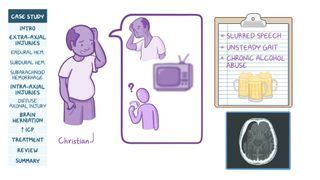 Basilar Skull Fracture: What Is It, Causes, Symptoms, and More | Osmosis