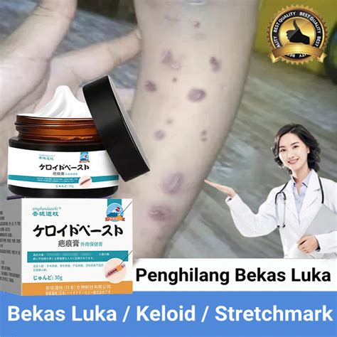 Jual Oripenghilang Bekas Luka Hitam Koreng Penghilang Bekas Luka