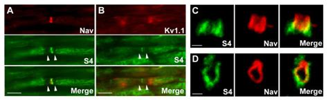 Localization Of S In Nodal Regions Of The Pns Sections Through Rat