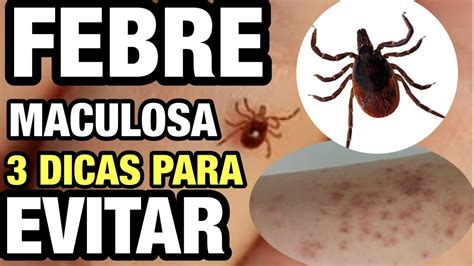 Surto De Febre Maculosa Saiba Como Evitar Contato O Carrapato Que