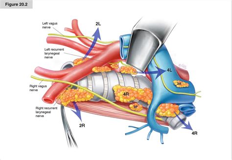 Lung Lymph Node Anatomy